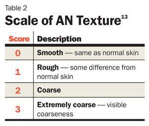 Acanthosis Nigricans