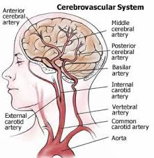 Stroke/Cerebrovascular Disease
