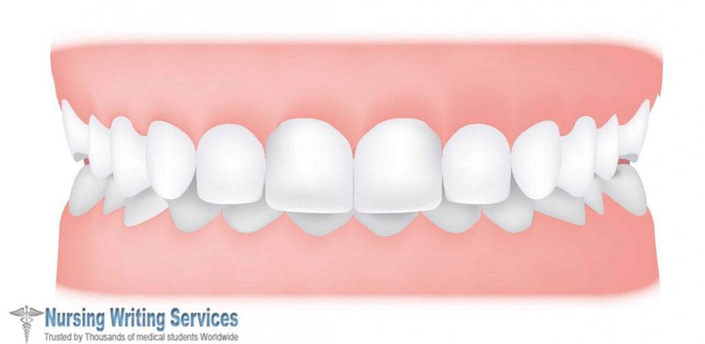 How to Treat and Prevent Common Dental Problems 