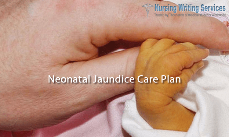 Neonatal Jaundice Care Plan Writing help