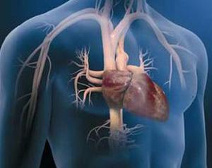 Pulmonary Arterial Hypertension