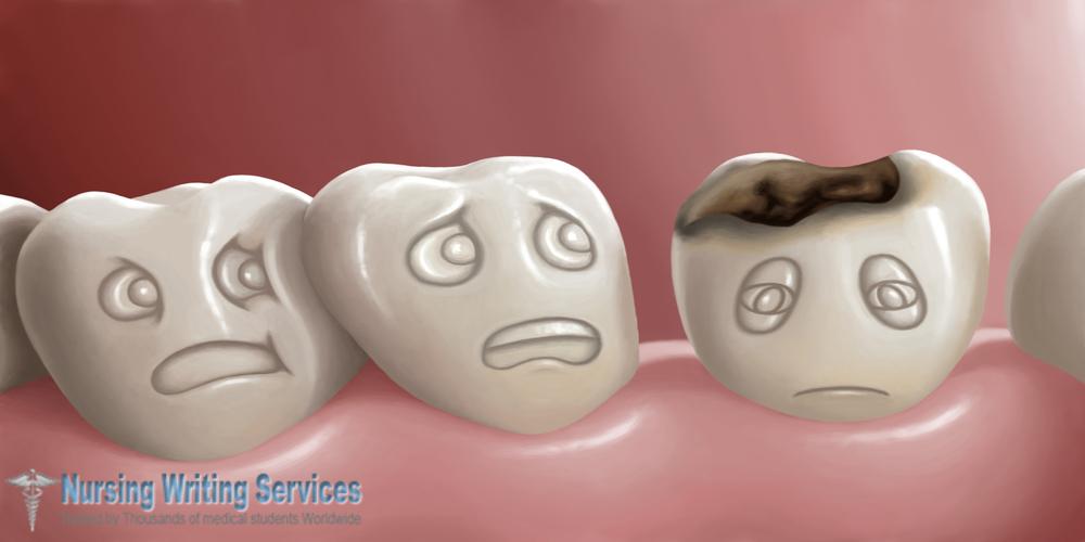 What Causes Tooth Decay 