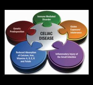 Celiac Disease