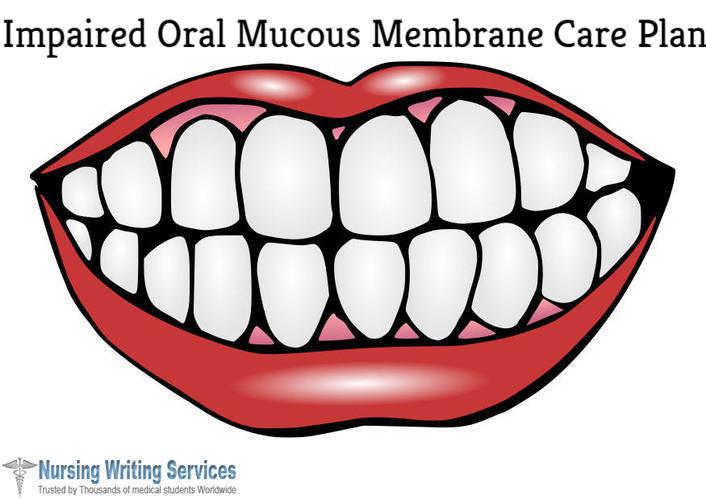 Impaired Oral Mucous Membrane Care Plan Writing Help Online